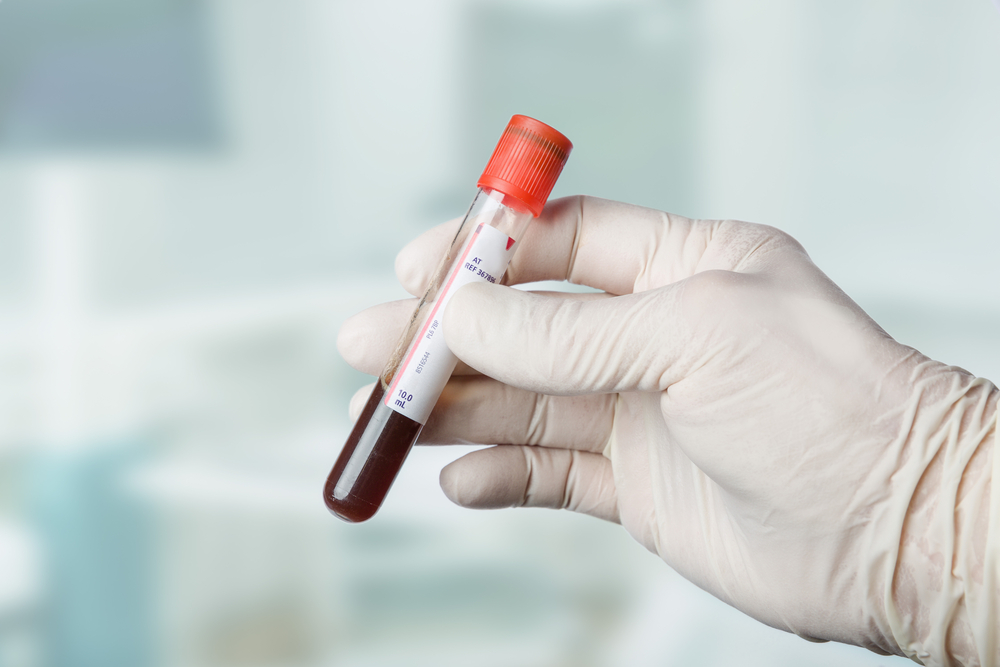 Cancer detection without a biopsy